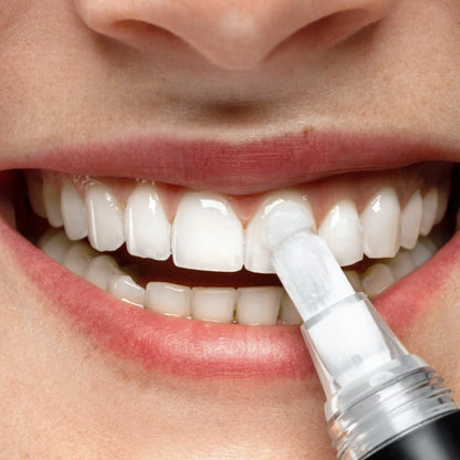 Smilepen Power Whitening Gel Kit