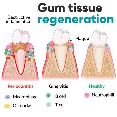 DentiZen™ Gingival Therapy Gel