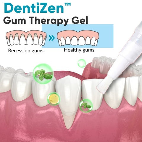 DentiZen™ Gingival Therapy Gel