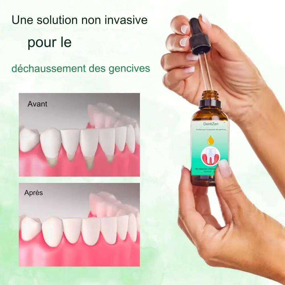 Gingival therapy gel