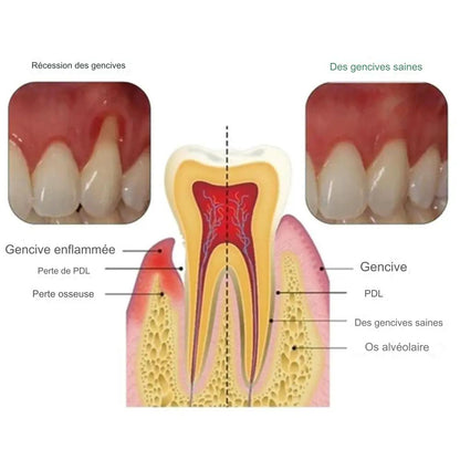 Gingival therapy gel